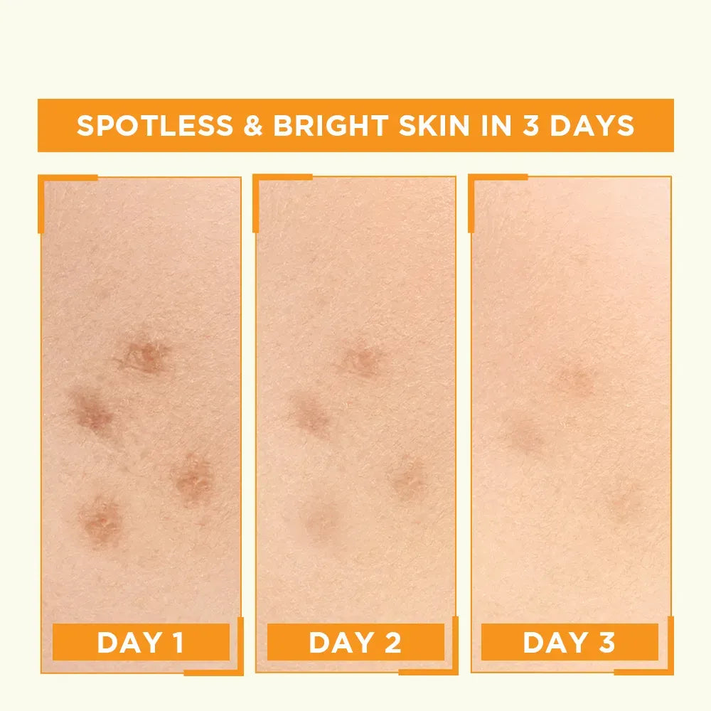 Garnier Skin Naturals Vitamin C Booster Serum 30ml