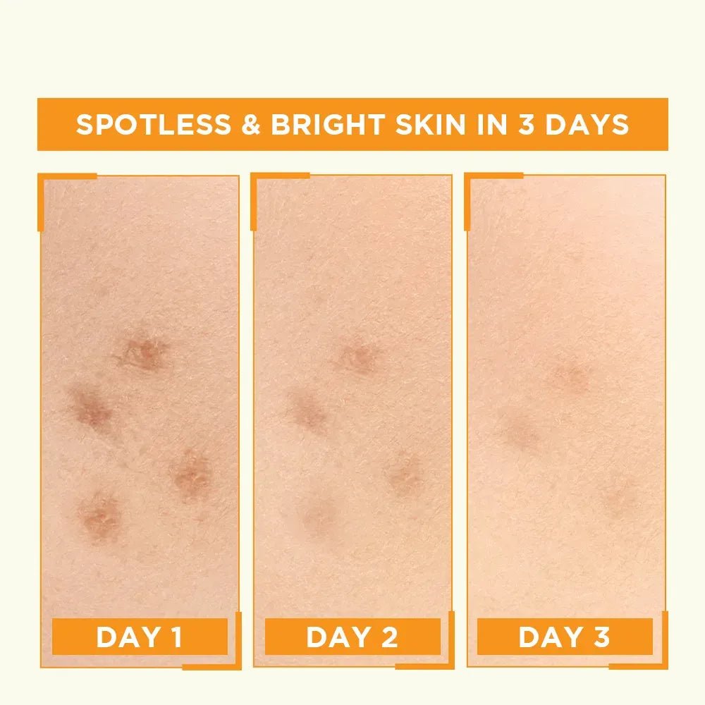 Garnier Skin Naturals Vitamin C Booster Serum 30ml - Glowndeals