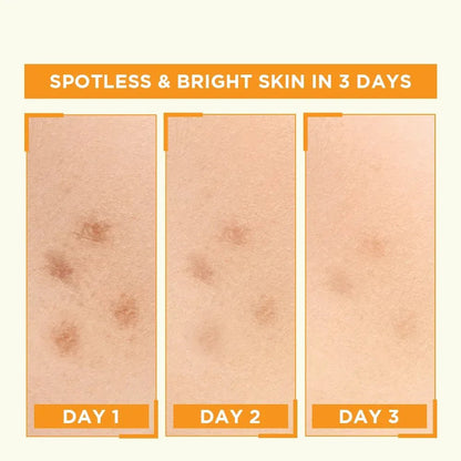 Garnier Skin Naturals Vitamin C Booster Serum 30ml - Glowndeals