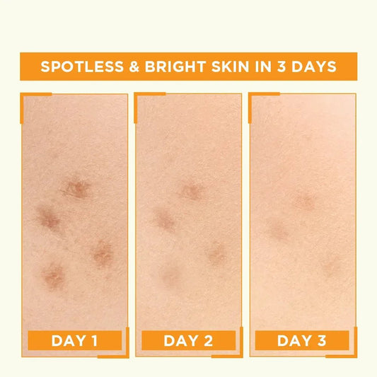 Garnier Skin Naturals Vitamin C Booster Serum 30ml - Glowndeals